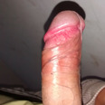 PedroVerxa